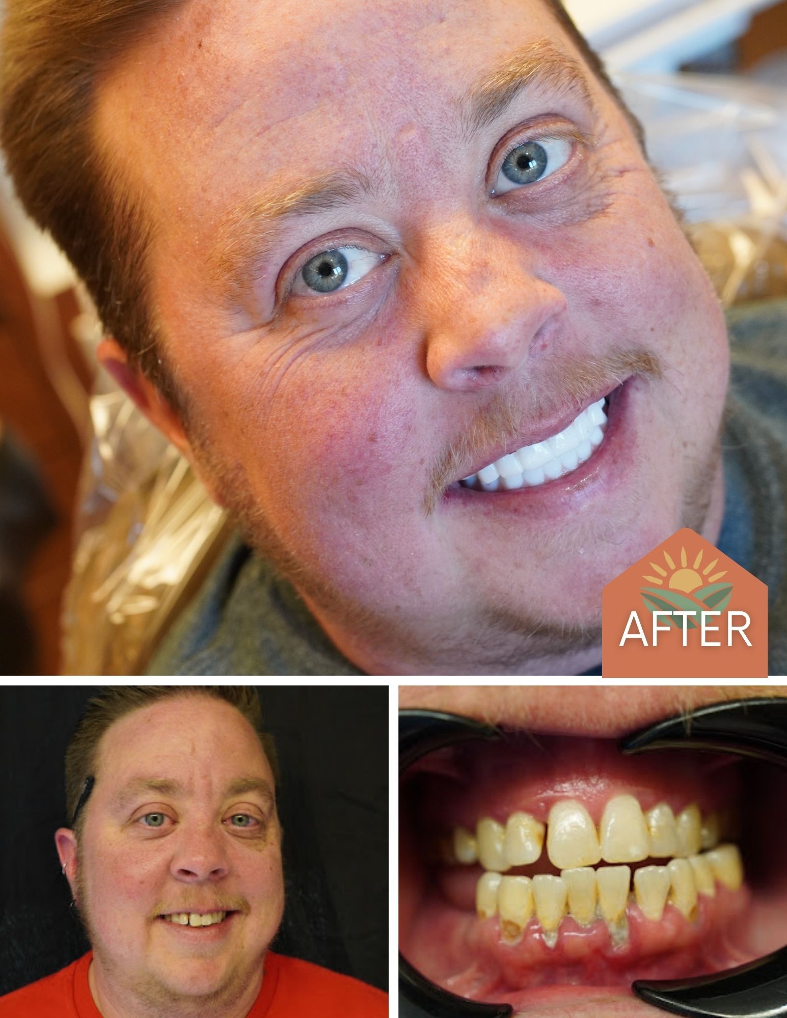 Before After Image