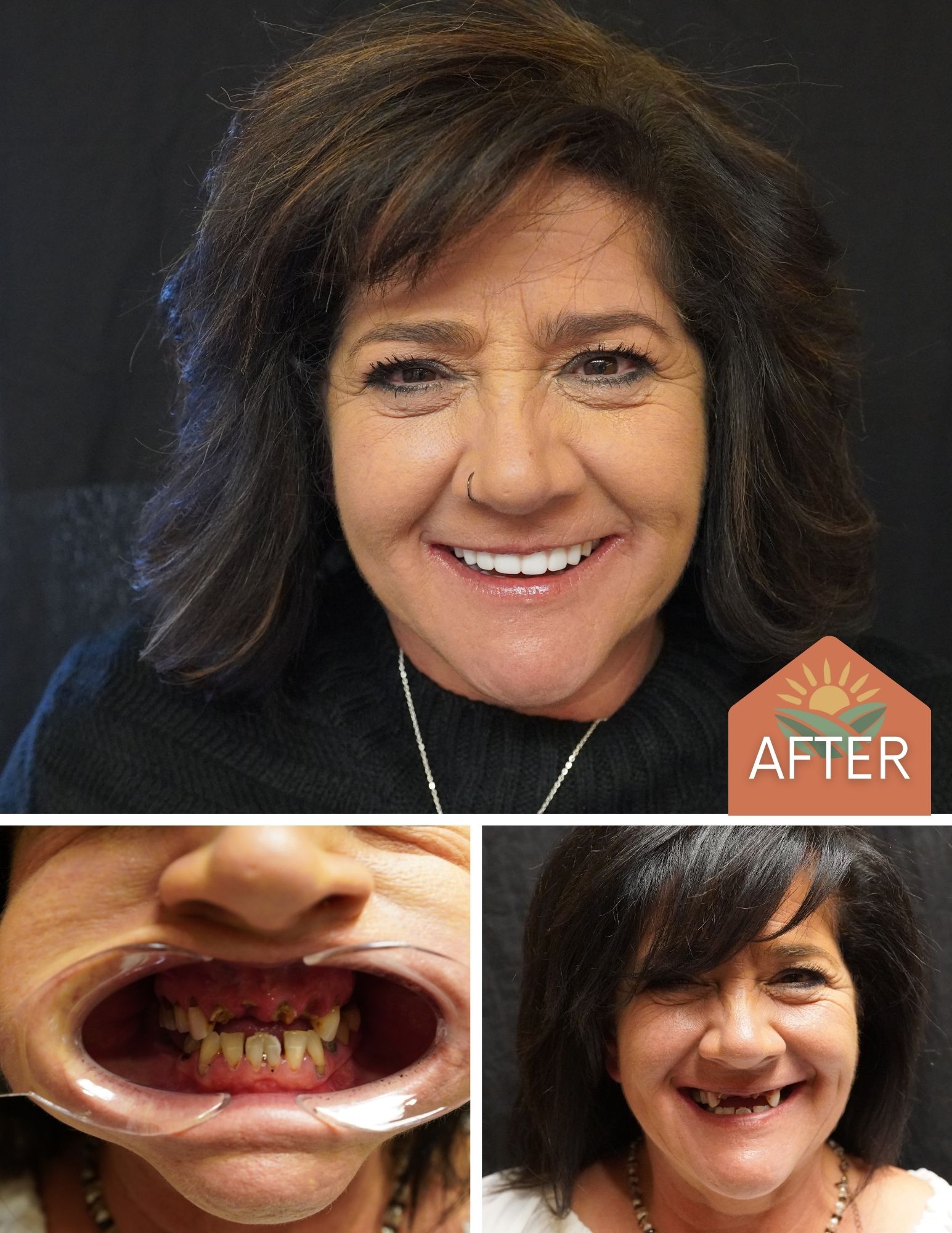 Before After Image