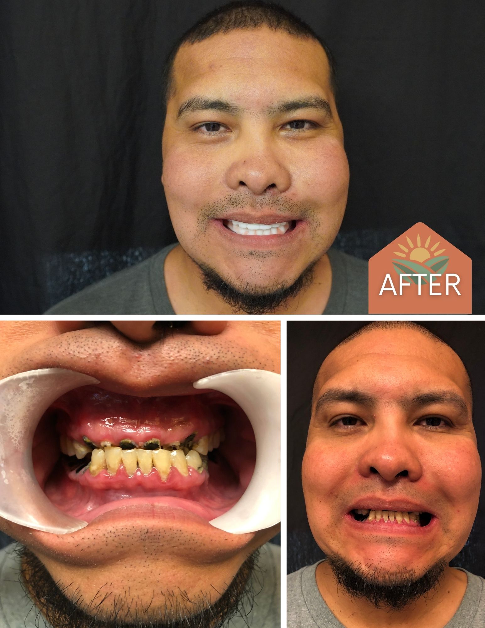 Before After Image