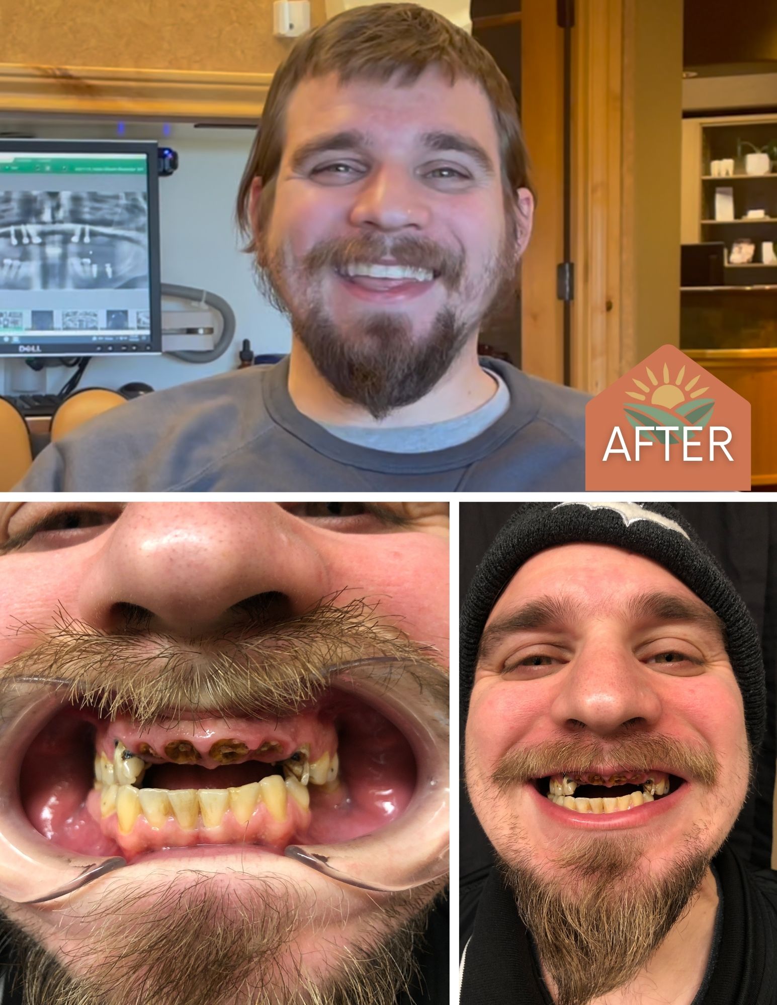 Before After Image