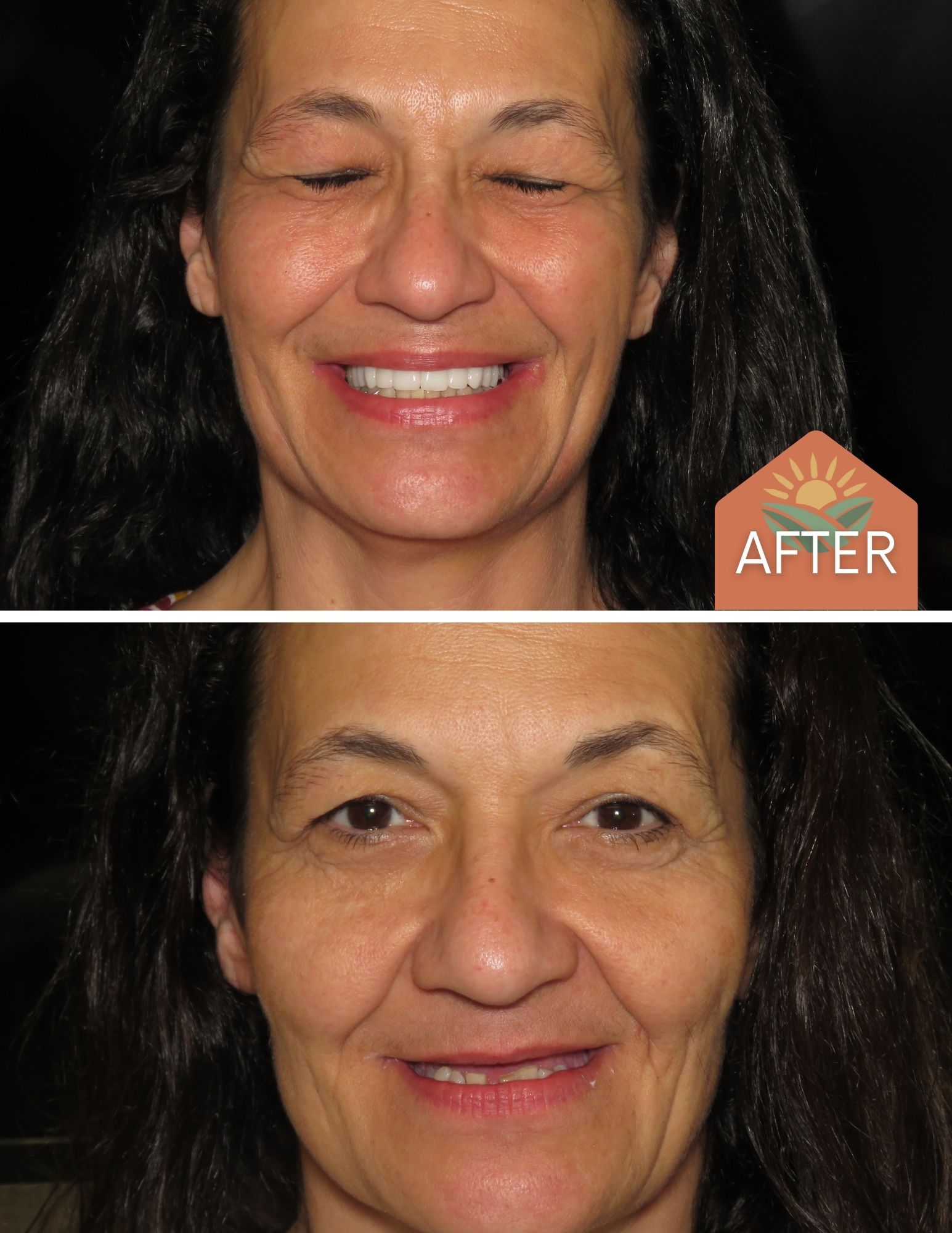 Before After Image