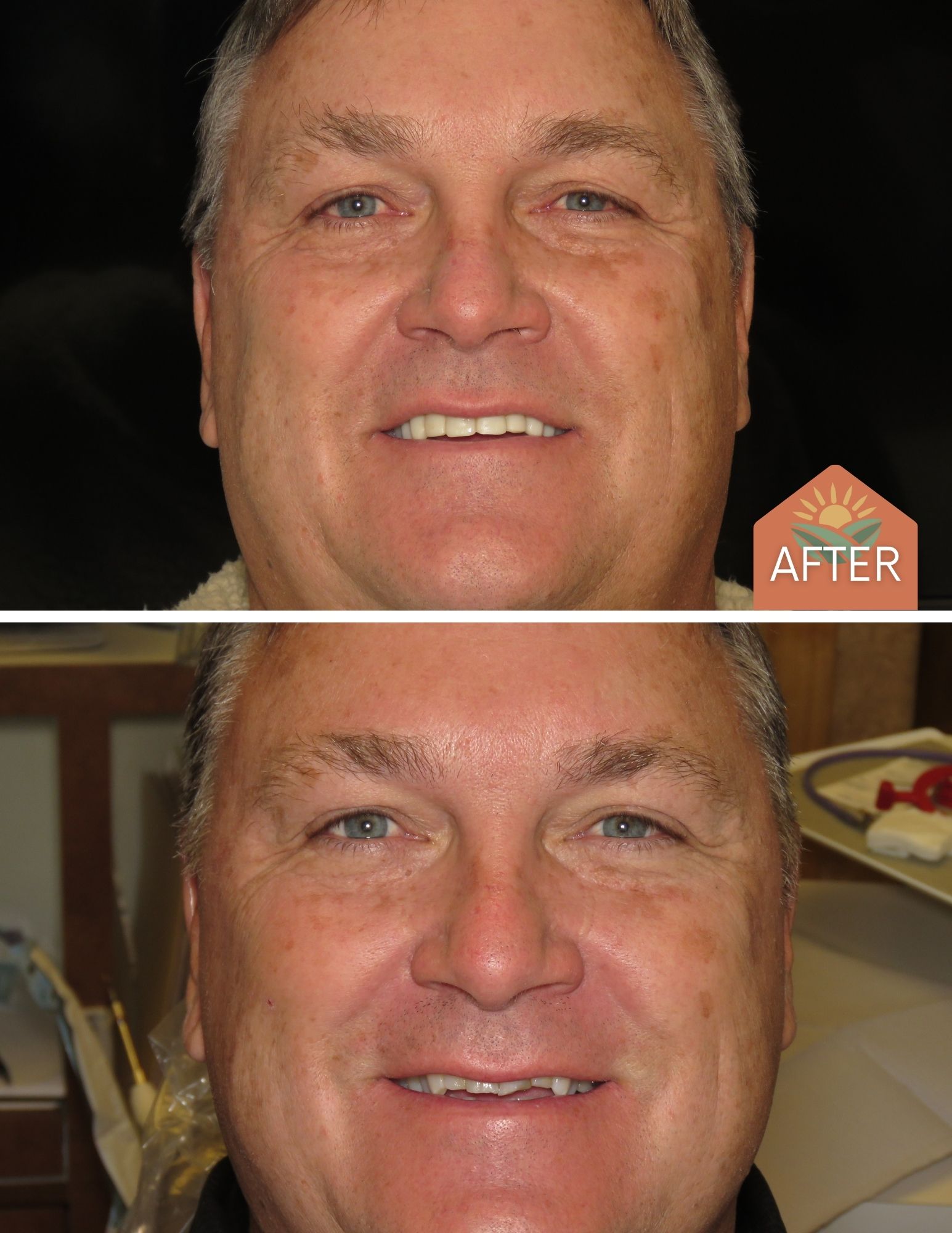 Before After Image