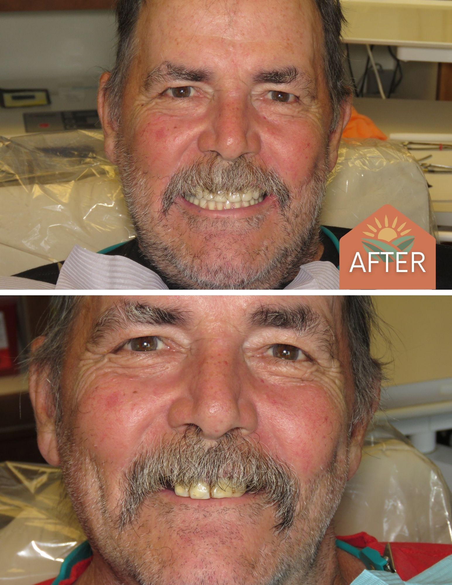 Before After Image