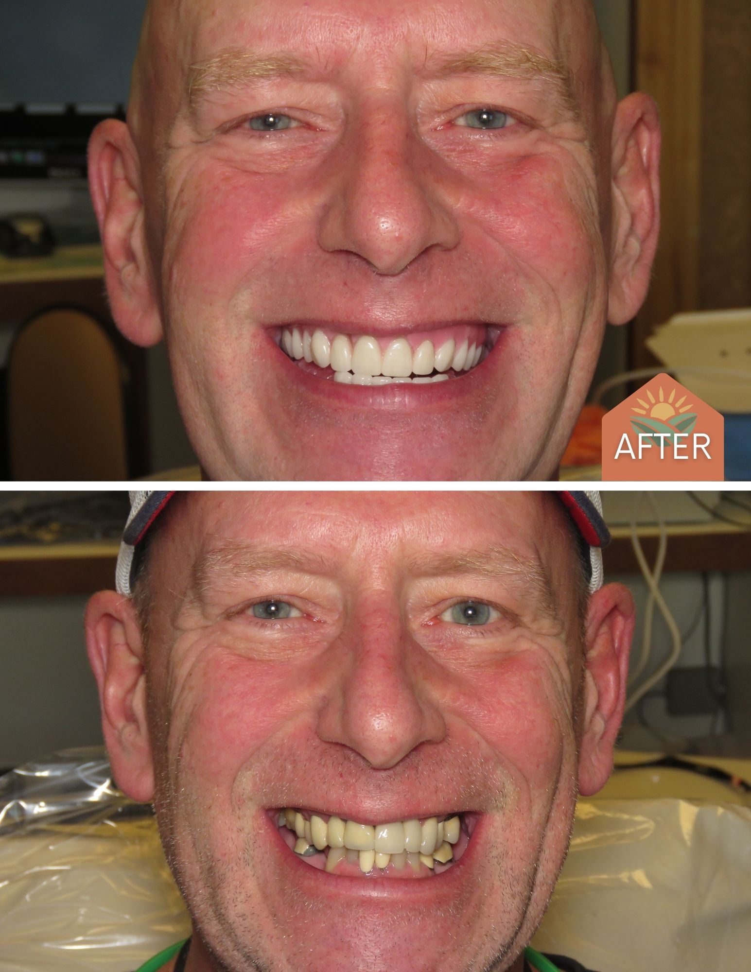Before After Image